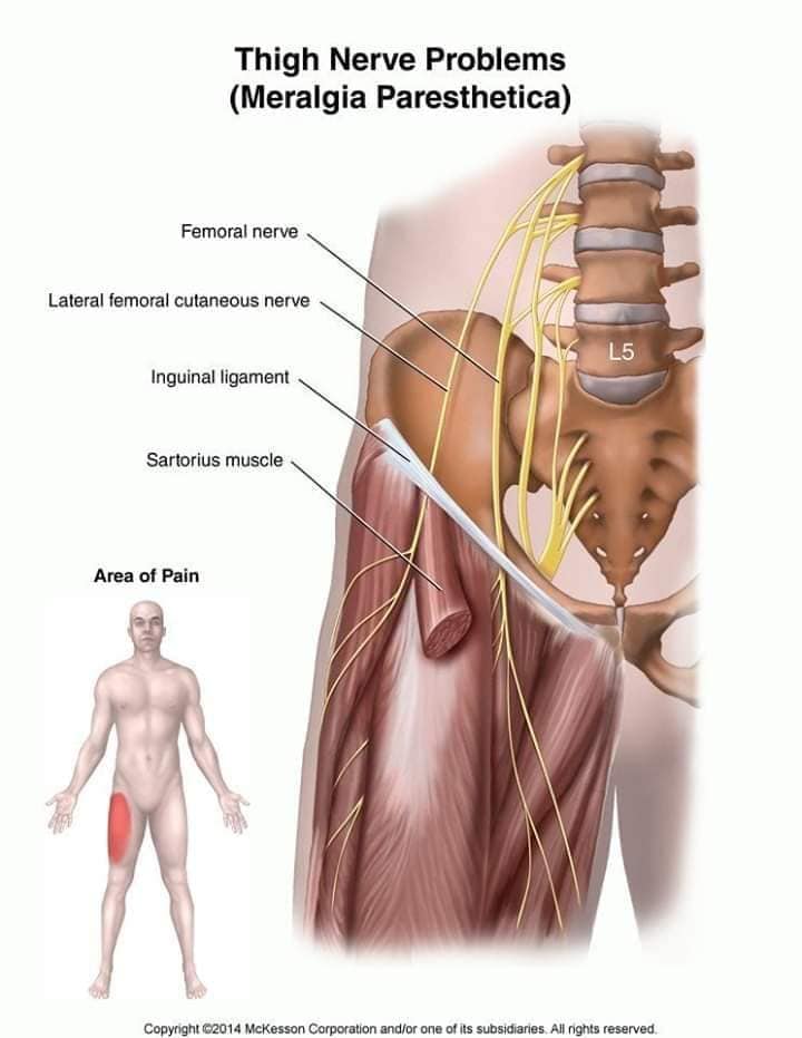 muscular-system82.jpg